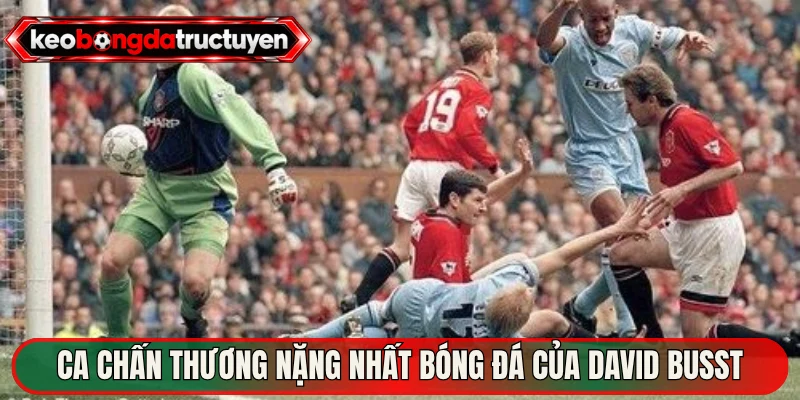Ca chấn thương nặng nhất bóng đá của David Busst